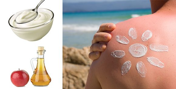 Einfache und kostengünstige Hausmittel gegen Sonnenbrand Einfache und kostengünstige Hausmittel gegen Sonnenbrand