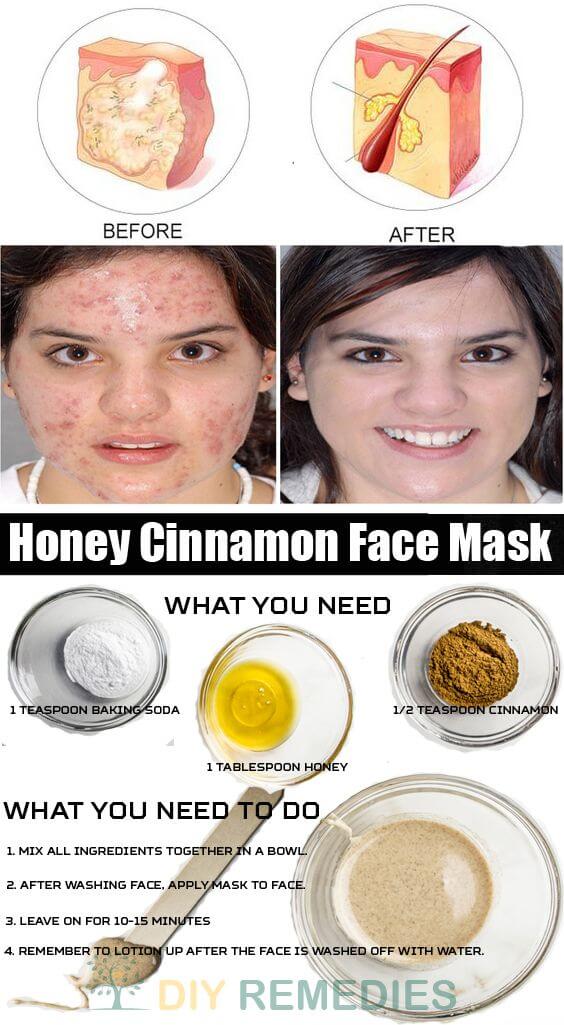 Naturkosmetik DIY Gesichtsmaske Honig und Zimt
